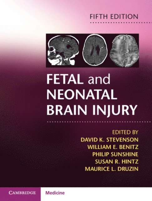 Maurice L. Druzin, Susan R. Hintz, Philip Sunshine, William E. Benitz, David K. Stevenson - Fetal and Neonatal Brain Injury, E-bok
