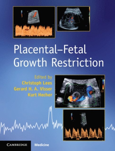 Kurt Hecher, Gerard H. A. Visser, Christoph Lees - Placental-Fetal Growth Restriction, E-bok