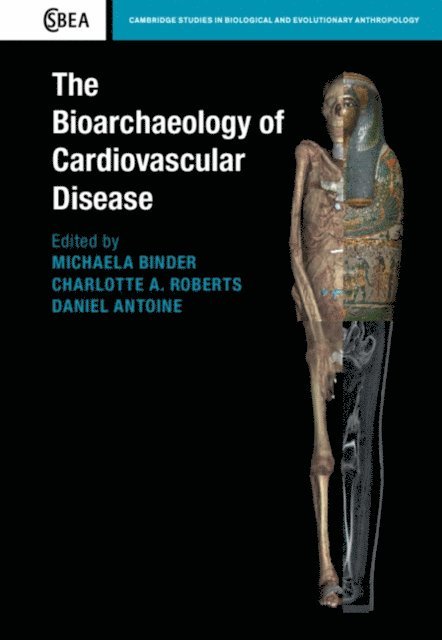 Daniel Antoine, Charlotte A. Roberts, Michaela Binder - Bioarchaeology of Cardiovascular Disease, E-bok
