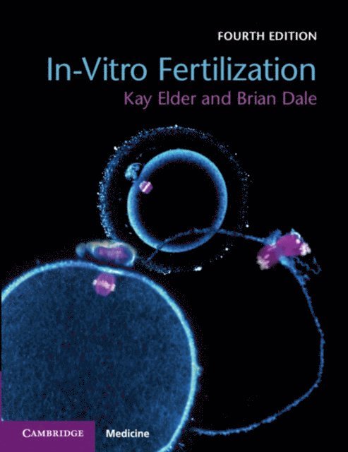 Brian Dale, Kay Elder - In-Vitro Fertilization, E-bok