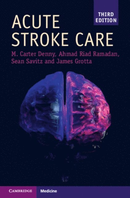 James Grotta, Sean I. Savitz, Ahmad Riad Ramadan, Mary Carter Denny - Acute Stroke Care, E-bok