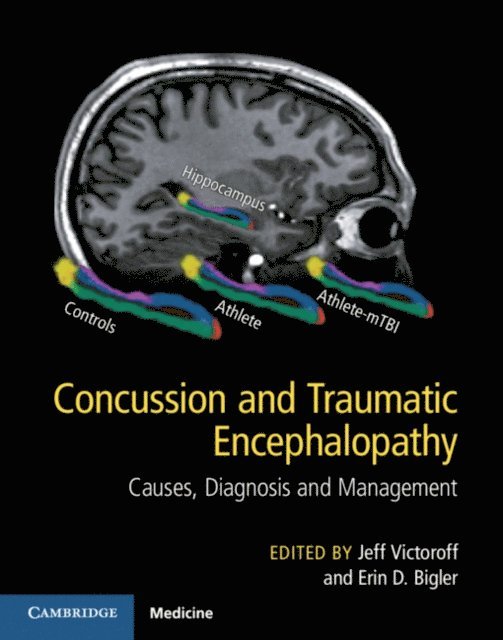 Erin D. Bigler, Jeff Victoroff - Concussion and Traumatic Encephalopathy, E-bok