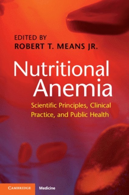 Robert T. Means Jr - Nutritional Anemia, E-bok. Tillgänglighet: Lägg i varukorg