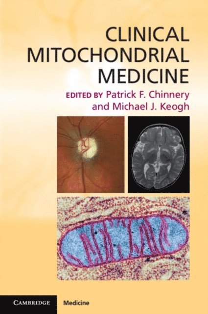 Michael J. Keogh, Patrick F. Chinnery - Clinical Mitochondrial Medicine, E-bok. Tillgänglighet: Lägg i varukorg