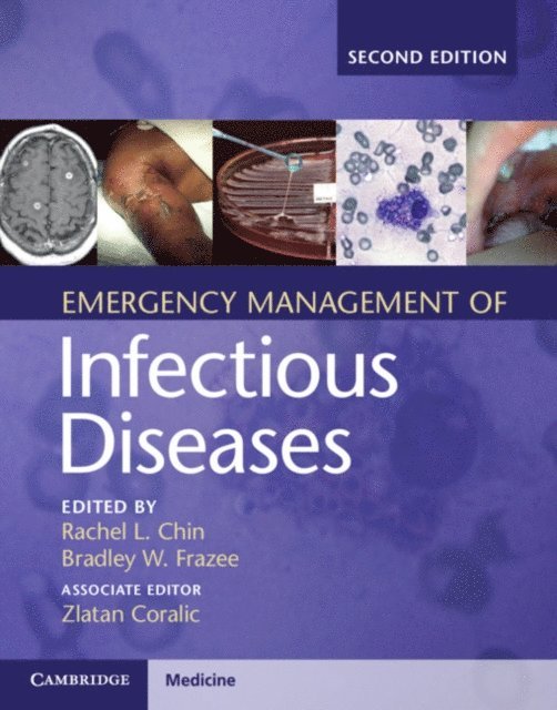 Zlatan Coralic, Bradley W. Frazee, Rachel L. Chin - Emergency Management of Infectious Diseases, E-bok
