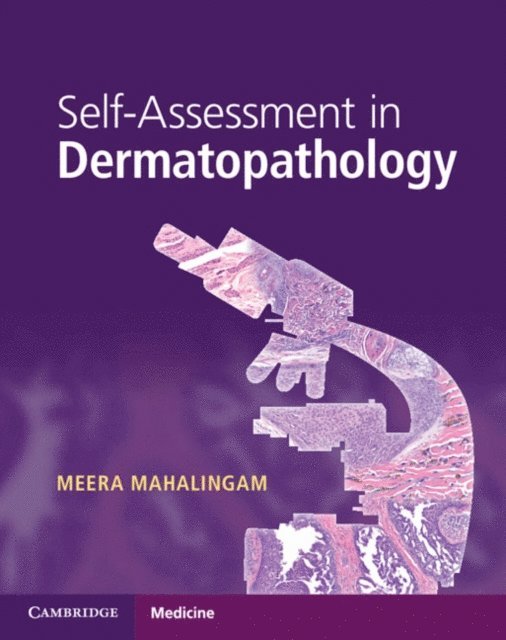 Meera Mahalingam - Self-Assessment in Dermatopathology, E-bok