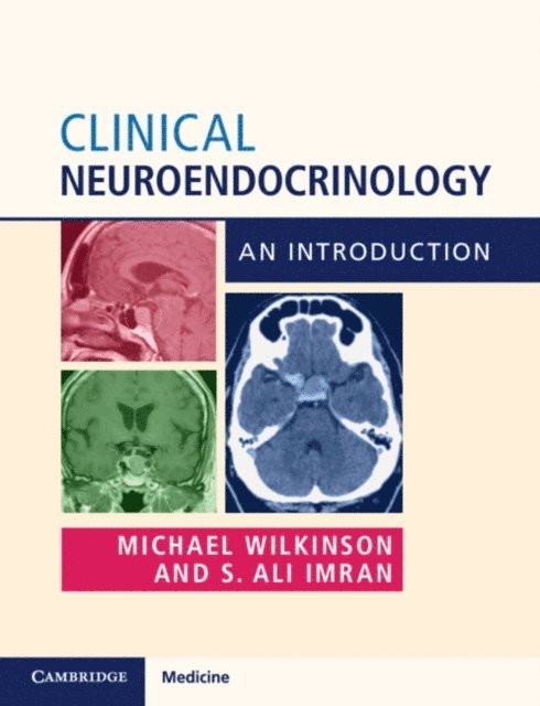 S. Ali Imran, Michael Wilkinson - Clinical Neuroendocrinology, E-bok