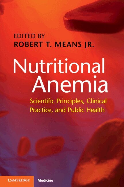 Robert T. Means Jr - Nutritional Anemia, Häftad. Tillgänglighet: Lägg i varukorg