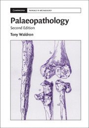 Palaeopathology av Tony Waldron, Tony Waldron