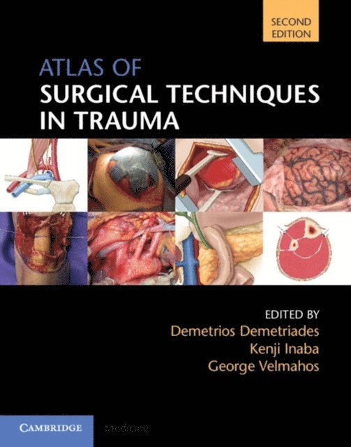 George Velmahos, Kenji Inaba, Demetrios Demetriades - Atlas of Surgical Techniques in Trauma, E-bok