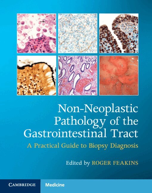 Roger M. Feakins - Non-Neoplastic Pathology of the Gastrointestinal Tract with Online Resource, Övrigt