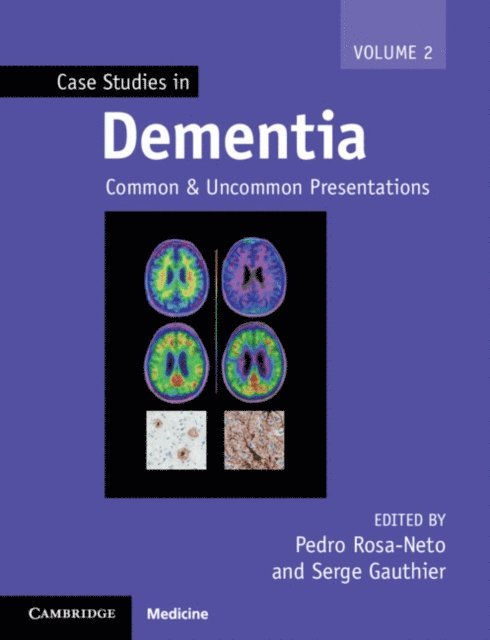 Serge Gauthier, Pedro Rosa-Neto - Case Studies in Dementia, E-bok