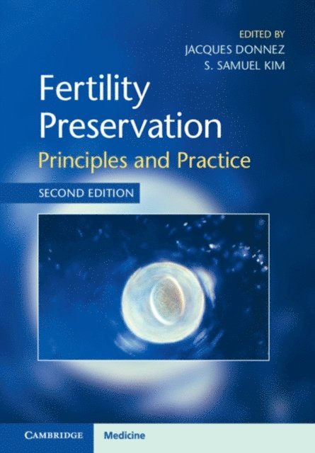 S. Samuel Kim, Jacques Donnez - Fertility Preservation, E-bok
