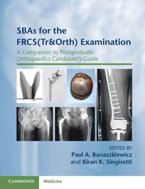Kiran K. Singisetti, Paul A. Banaszkiewicz - SBAs for the FRCS(Tr&Orth) Examination, E-bok