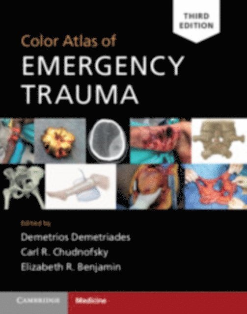 Elizabeth R. Benjamin, Carl R. Chudnofsky, Demetrios Demetriades - Color Atlas of Emergency Trauma, E-bok