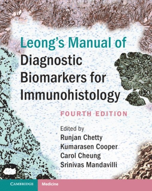 Srinivas Mandavilli, Carol Cheung, Kumarasen Cooper, Runjan Chetty - Leong's Manual of Diagnostic Biomarkers for Immunohistology, E-bok