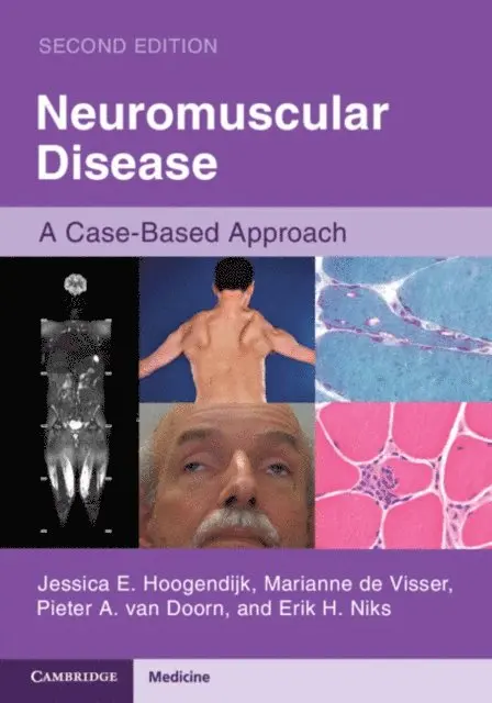 Erik H. Niks, Pieter A. van Doorn, Marianne de Visser, Jessica E. Hoogendijk - Neuromuscular Disease, E-bok. Tillgänglighet: Lägg i varukorg