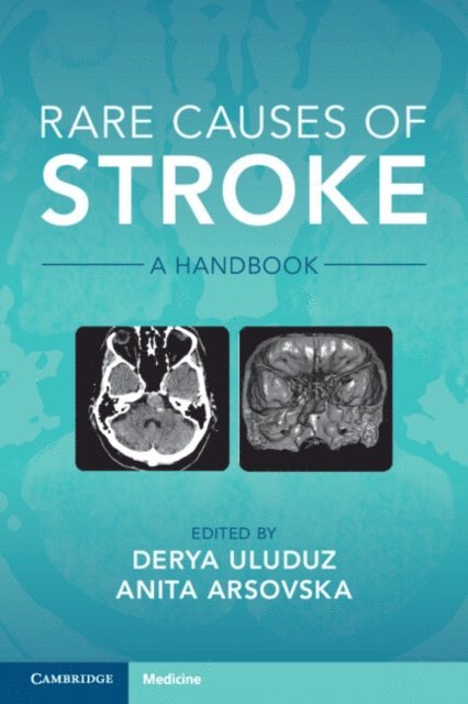 Anita Arsovska, Derya Uluduz - Rare Causes of Stroke, E-bok