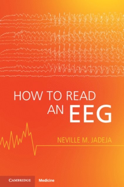 Neville M. Jadeja - How to Read an EEG, E-bok. Tillgänglighet: Lägg i varukorg