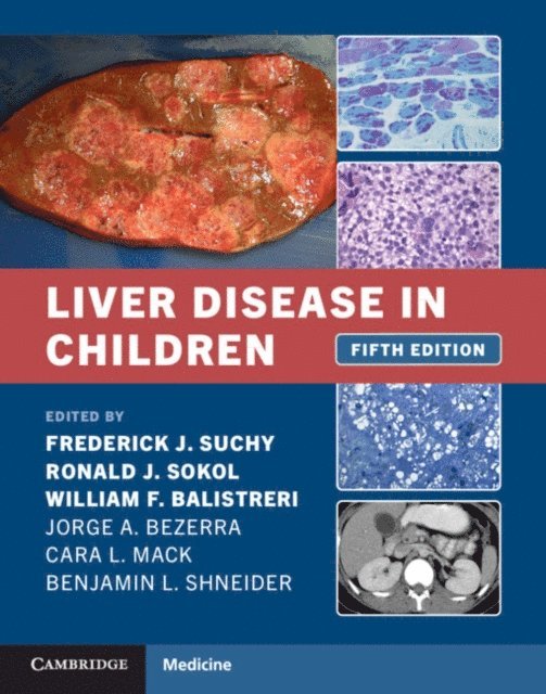William F. Balistreri, Ronald J. Sokol, Frederick J. Suchy - Liver Disease in Children, E-bok