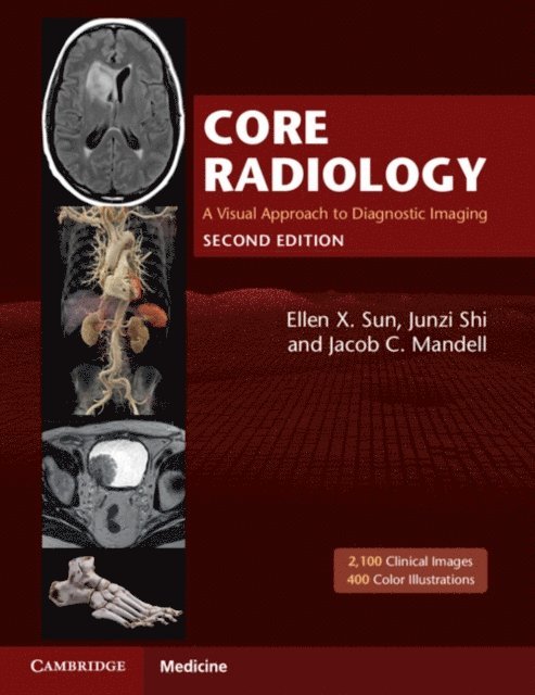 Jacob C. Mandell, Junzi Shi, Ellen X. Sun - Core Radiology, E-bok