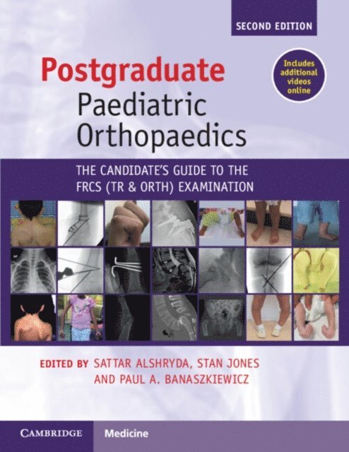 Paul A. Banaszkiewicz, Stan Jones, Sattar Alshryda - Postgraduate Paediatric Orthopaedics, E-bok