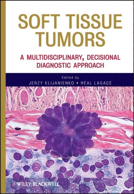Real Lagace, Jerzy Klijanienko - Soft Tissue Tumors, E-bok