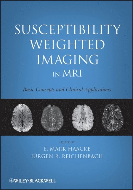 Jurgen R. Reichenbach, E. Mark Haacke - Susceptibility Weighted Imaging in MRI : Basic Concepts and Clinical Applications, E-bok