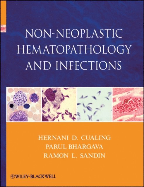 Ramon L. Sandin, Parul Bhargava, Hernani Cualing - Non-Neoplastic Hematopathology and Infections, E-bok. Tillgänglighet: Lägg i varukorg