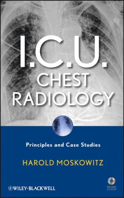 Harold Moskowitz - I.C.U. Chest Radiology, E-bok. Tillgänglighet: Lägg i varukorg