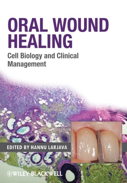 Hannu Larjava - Oral Wound Healing, E-bok