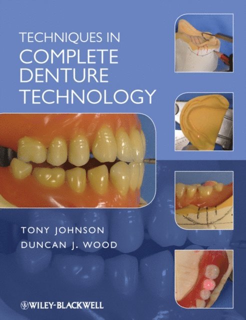 Duncan J. Wood, Tony Johnson - Techniques in Complete Denture Technology, E-bok