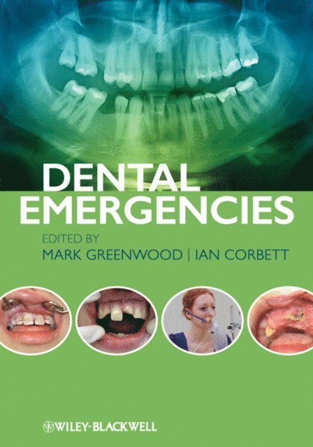 Ian Corbett, Mark Greenwood - Dental Emergencies, E-bok