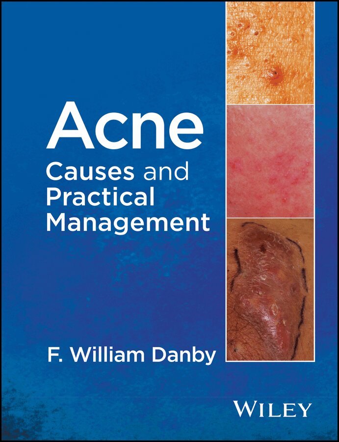 F. William Danby - Acne – Causes and Practical Management. Tillgänglighet: Tillfälligt slut