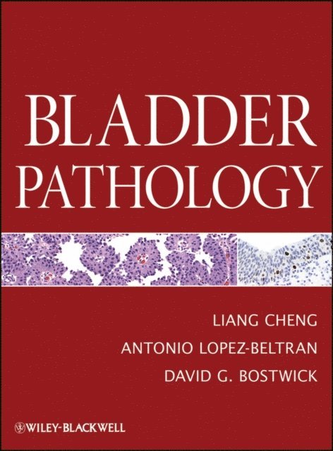 David G. Bostwick, Antonio Lopez-Beltran, Liang Cheng - Bladder Pathology, E-bok
