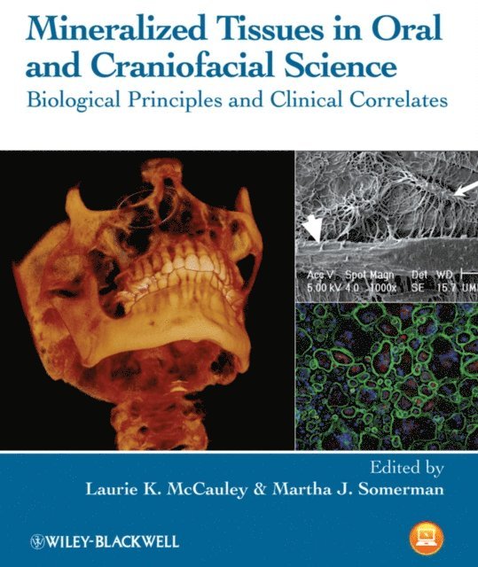 Martha J. Somerman, Laurie K. McCauley - Mineralized Tissues in Oral and Craniofacial Science, E-bok. Tillgänglighet: Lägg i varukorg