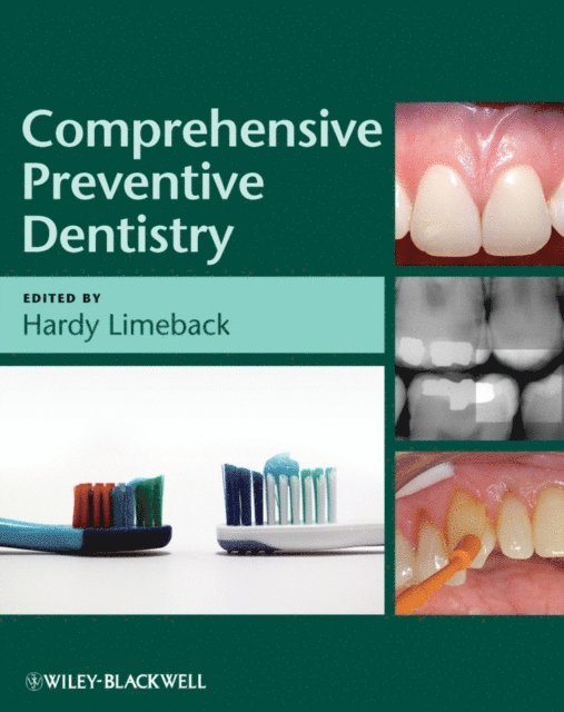 Hardy Limeback - Comprehensive Preventive Dentistry, E-bok. Tillgänglighet: Lägg i varukorg