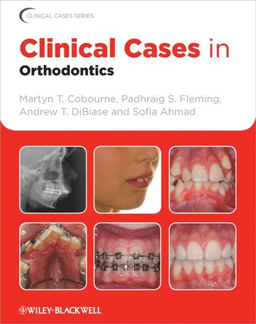 Sofia Ahmad, Andrew T. DiBiase, Padhraig S. Fleming, Martyn T. Cobourne - Clinical Cases in Orthodontics, E-bok