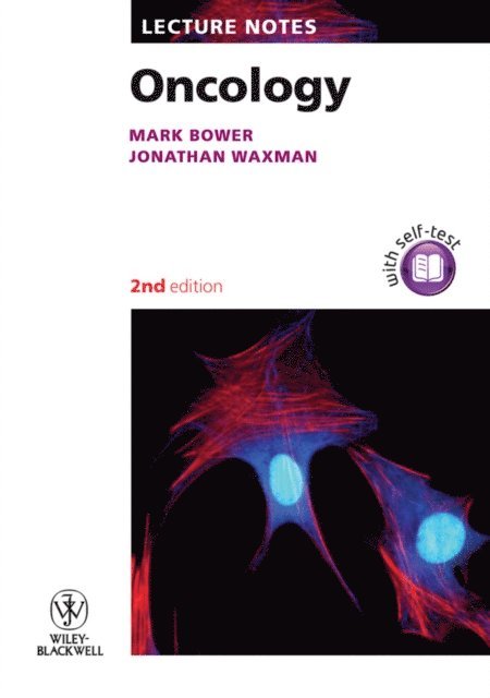 Jonathan Waxman, Mark Bower - Oncology, E-bok