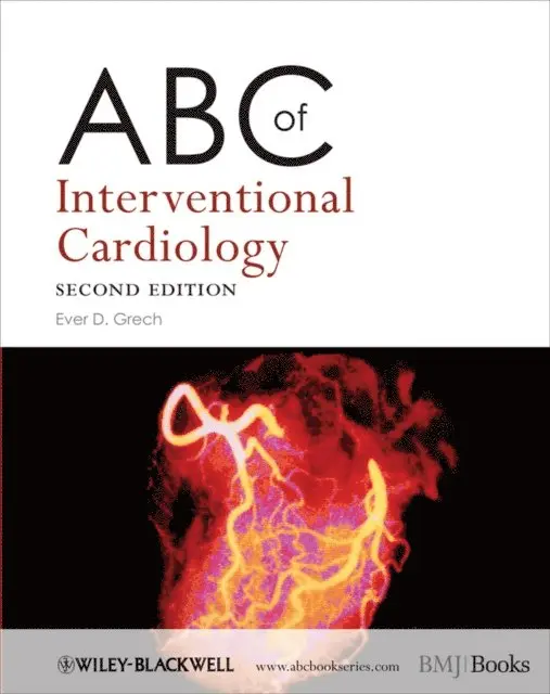 Ever D. Grech - ABC of Interventional Cardiology, E-bok. Tillgänglighet: Lägg i varukorg