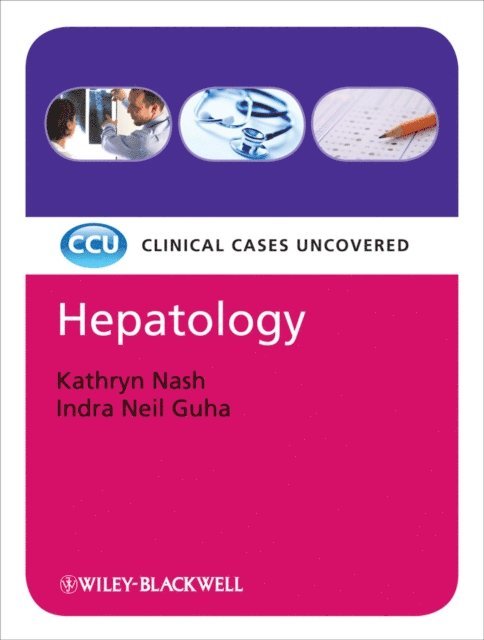 Indra Neil Guha, Kathryn Nash - Hepatology: Clinical Cases Uncovered, E-bok