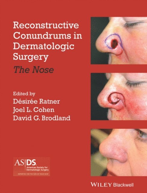 David Brodland, Joel L. Cohen, Desiree S. Ratner - Reconstructive Conundrums in Dermatologic Surgery, E-bok