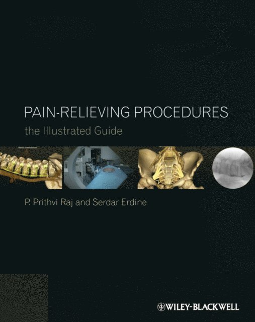 Serdar Erdine, P. Prithvi Raj - Pain-Relieving Procedures, E-bok