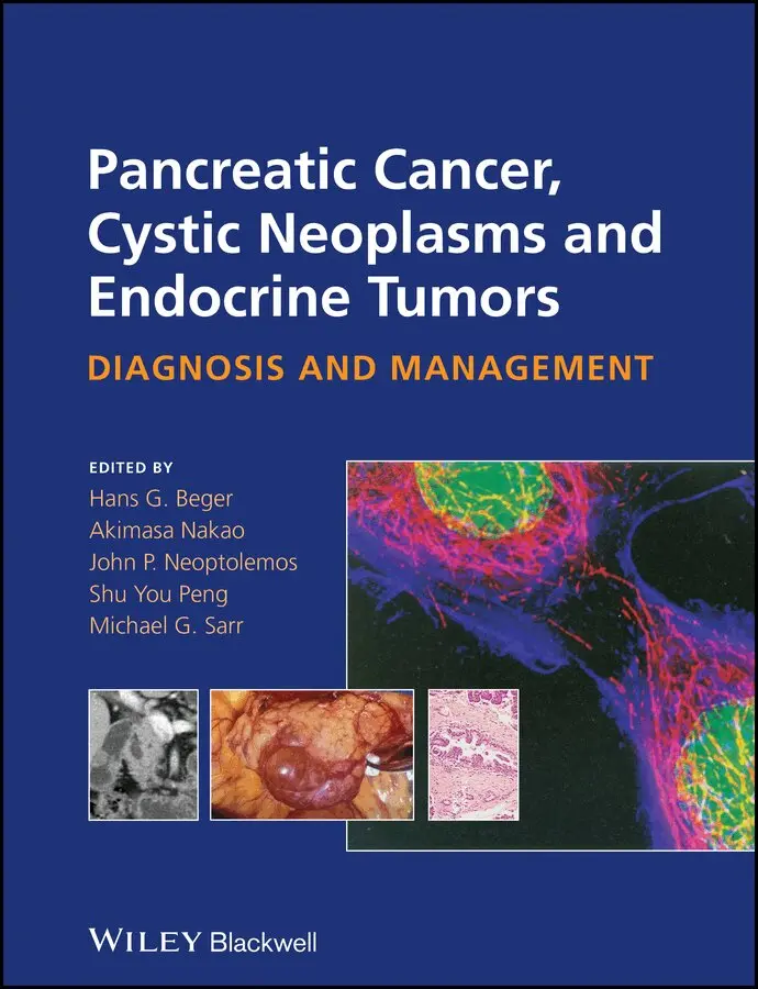 HG Beger - Pancreatic Cancer, Cystic Neoplasms and Endocrine Tumors – Diagnosis and Management. Tillgänglighet: Tillfälligt slut