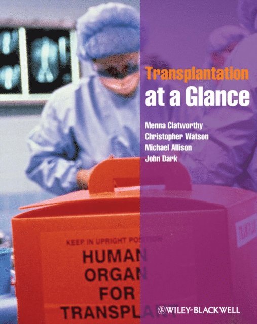 John Dark, Michael Allison, Christopher Watson, Menna Clatworthy - Transplantation at a Glance, E-bok