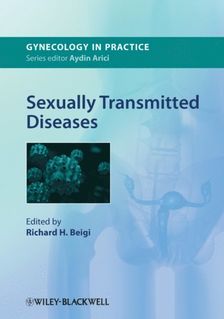 Richard H. Beigi - Sexually Transmitted Diseases, E-bok