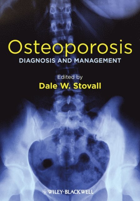 Dale W. Stovall - Osteoporosis, E-bok