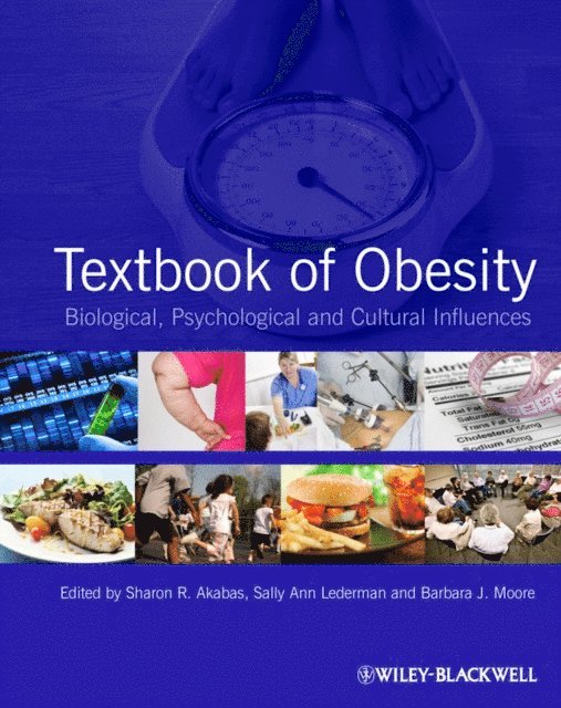Barbara J. Moore, Sally Ann Lederman, Sharon R. Akabas - Textbook of Obesity, E-bok. Tillgänglighet: Lägg i varukorg