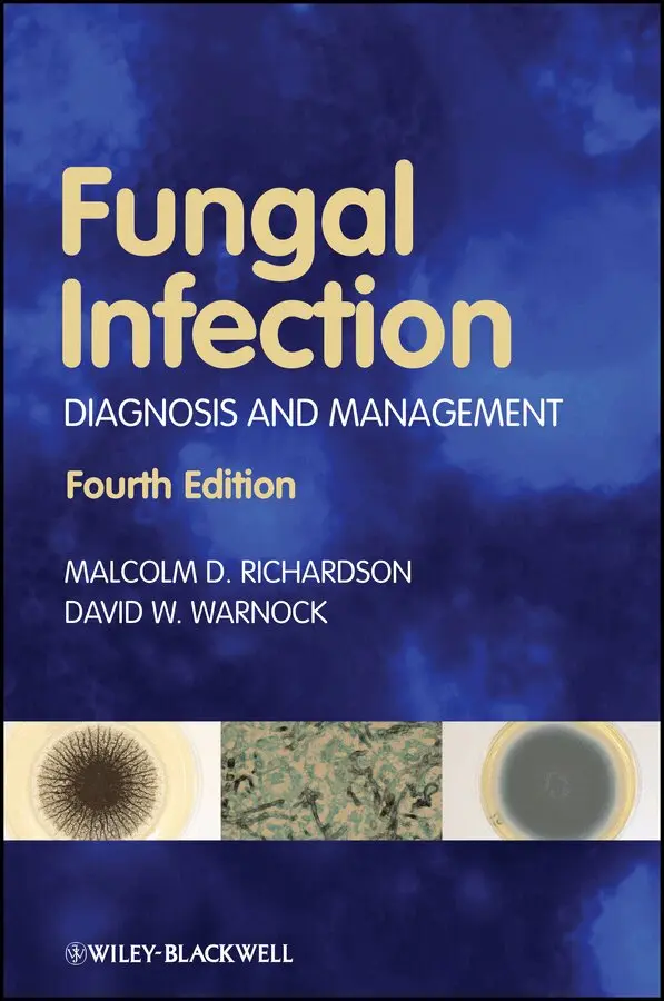 M Richardson - Fungal Infection – Diagnosis and Management. Tillgänglighet: Tillfälligt slut