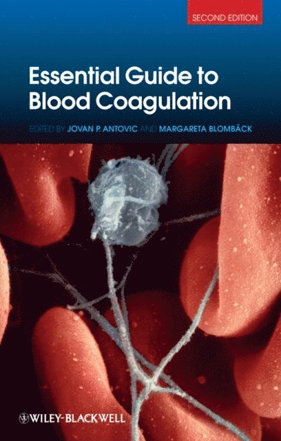 Margareta Blomb ck, Jovan P. Antovic - Essential Guide to Blood Coagulation, E-bok